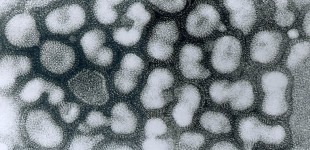 Influenza